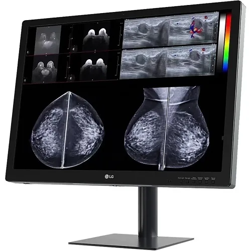 LG Pro 31HN713D-B 31" 12MP IPS Diagnostic Monitor for Mammography with Multi-resolution Modes, Pathology Mode, Self-calibration, Focus View, PBP and Dual Controller, 4200 x 2800